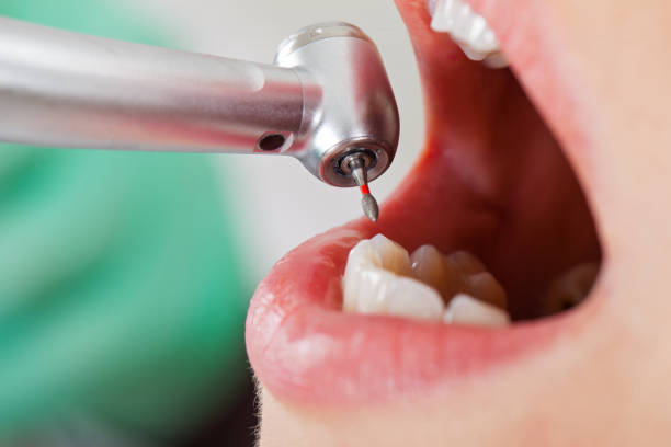 Best Urgent Dental Care for Toothache in Larksville, PA